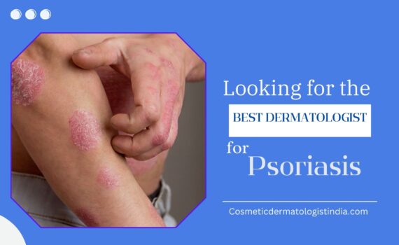 Best Dermatologist in Mumbai For Psoriasis