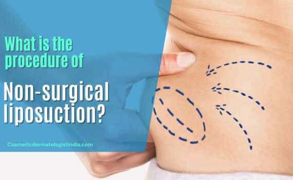 non-surgical liposuction