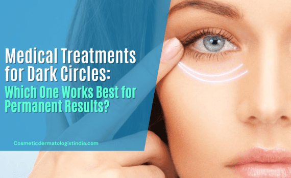 MEDICAL TREATMENTS FOR DARK CIRCLES: WHICH ONE WORKS BEST FOR PERMANENT RESULTS?