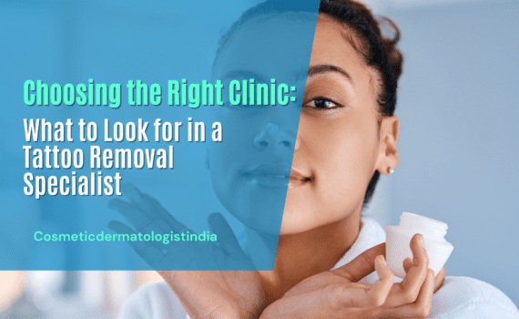 Choosing the Right Clinic: What to Look for in a Tattoo Removal Specialist