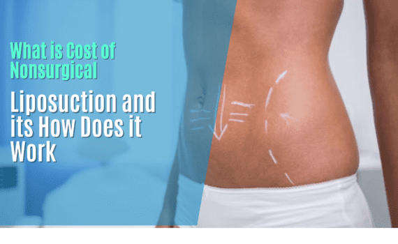 Non-Surgical Liposuction