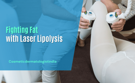 Laser Lipolysis