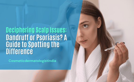 psoriasis treatment in mumbai