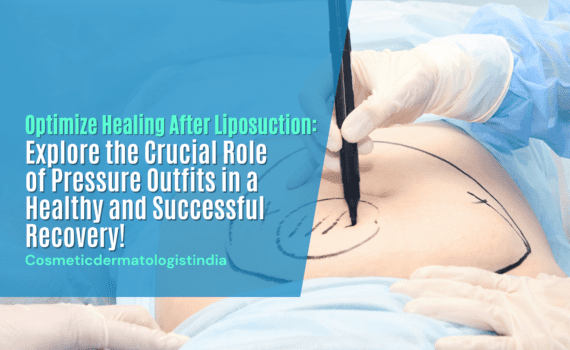 Non Surgical Liposuction, Cosmeticdermatologistindia